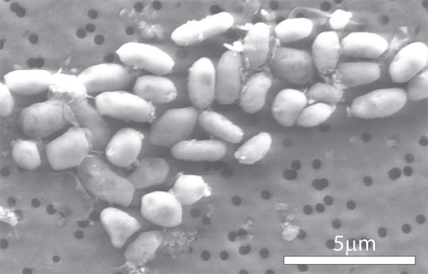 'Arsenic Life' Claim Refuted by 2 New Studies